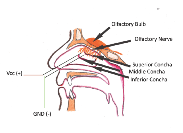 Figure 3: The inner part of the nasal conchae and the placement of the electrodes.